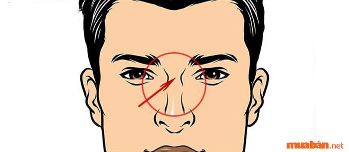 Sơn căn lõm là dấu hiệu của một tướng mệnh xấu