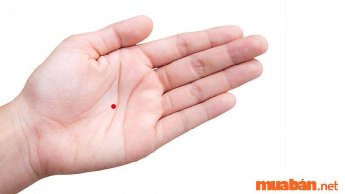 Những nốt ruồi may mắn