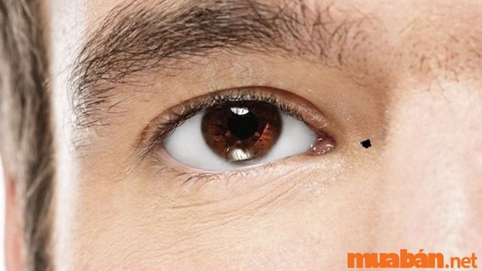Nốt ruồi ở khóe mắt nam giới