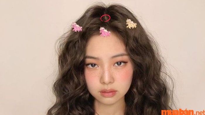 Giải mã ý nghĩa nốt ruồi trên đỉnh đầu