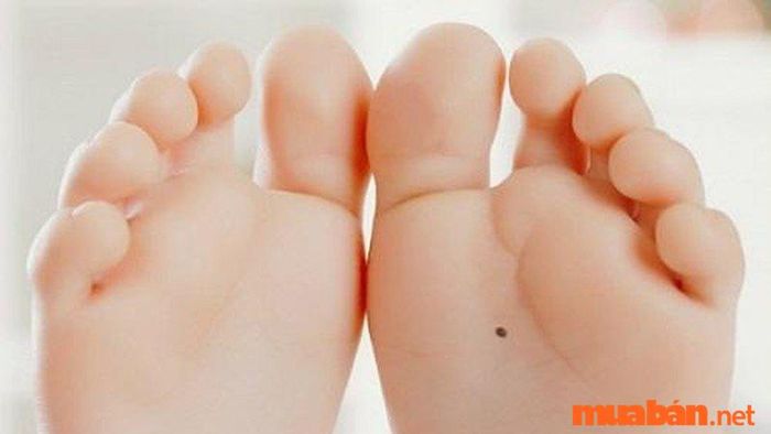 Những nốt ruồi may mắn