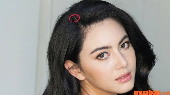Giải mã nốt ruồi trên đỉnh đầu bên phải
