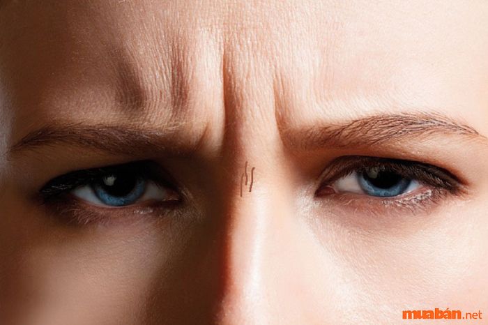 Người có sơn căn với nếp nhăn dễ gặp họa sát thân