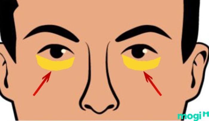 Sao Tam Thai tại cung Tử Túc liên quan đến con cái, đặc biệt là việc nuôi dạy con cái và các mối quan hệ gia đình.