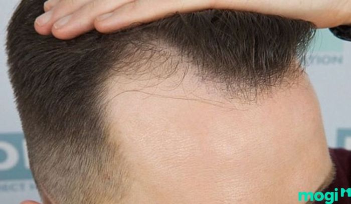 Chiếc trán được xem là biểu tượng đặc trưng của sao Tam Thai