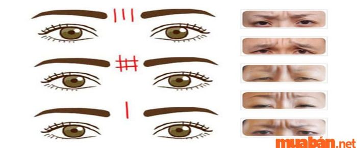 Ấn đường là gì: Ấn đường có nếp nhăn