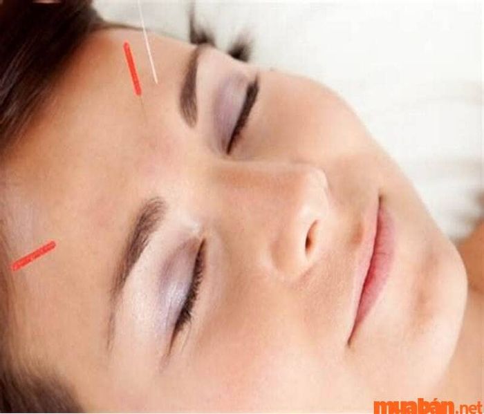 Ấn đường là gì? Vai trò của nó trong Châm cứu theo Y học cổ truyền