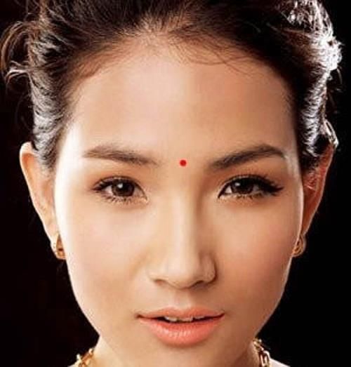 Nốt ruồi ở Ấn đường