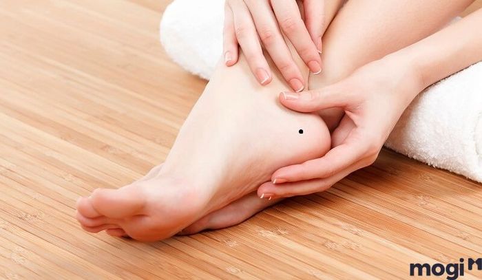 Nốt ruồi ở chân: Tốt hay xấu?