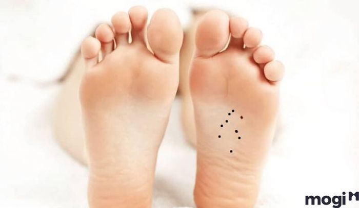 Người sở hữu 9 nốt ruồi dưới lòng bàn chân
