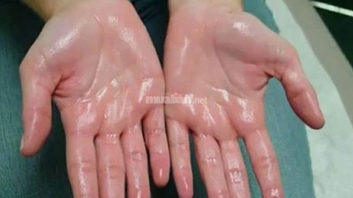Cách sử dụng cây xương khỉ trong bài thuốc hỗ trợ điều trị phong thấp