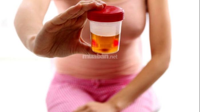 Hướng dẫn sử dụng cây xương khỉ trong bài thuốc hỗ trợ điều trị tiểu buốt, tiểu rắt, ra máu