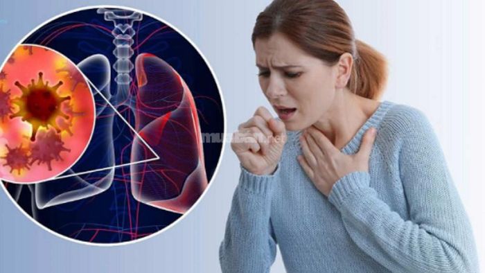 Hướng dẫn sử dụng cây xương khỉ trong bài thuốc trị ho