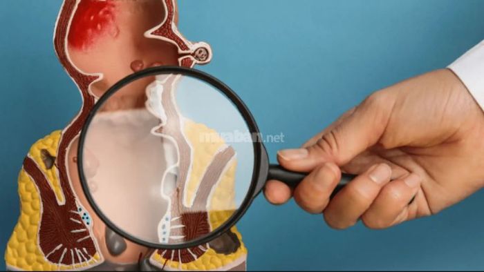 Cách dùng cây xương khỉ trong bài thuốc hỗ trợ điều trị trĩ