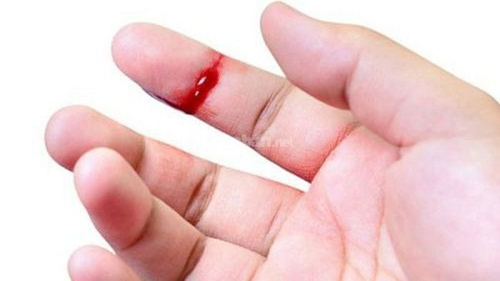 Cách dùng cây xương khỉ trong bài thuốc hỗ trợ cầm máu