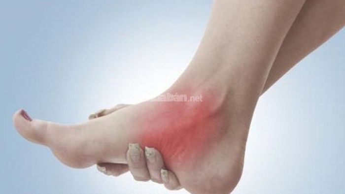Cách dùng cây xương khỉ trong bài thuốc hỗ trợ điều trị bong gân