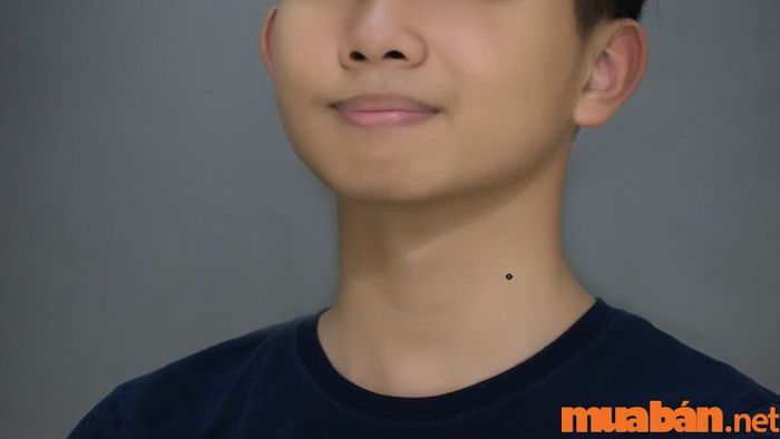 Nốt Ruồi Ở Bên Trái Cổ Nam Giới Có Ý Nghĩa Gì?