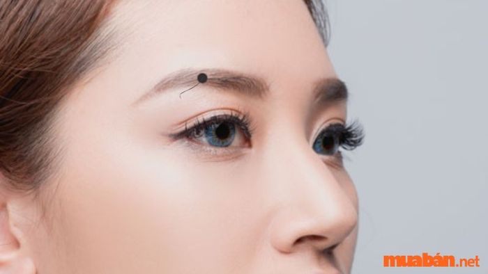 Nốt ruồi mọc lông