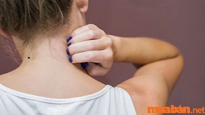 Nốt ruồi ở đằng sau cổ có ý nghĩa gì?