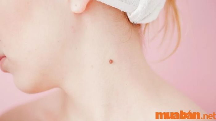 Nốt Ruồi Ở Bên Trái Cổ Nữ Giới Có Ý Nghĩa Gì?