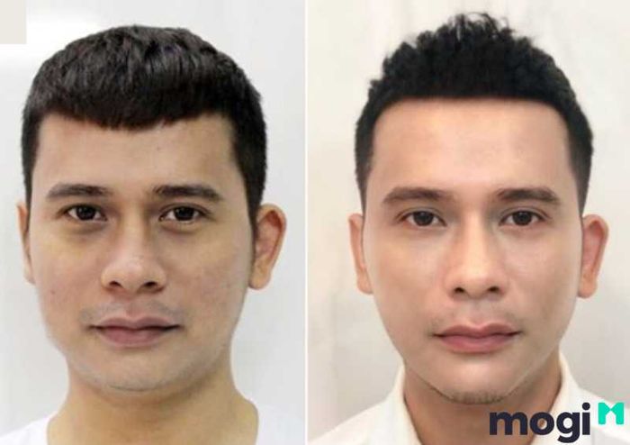 Ý nghĩa vận mệnh của nam giới sở hữu cằm tròn