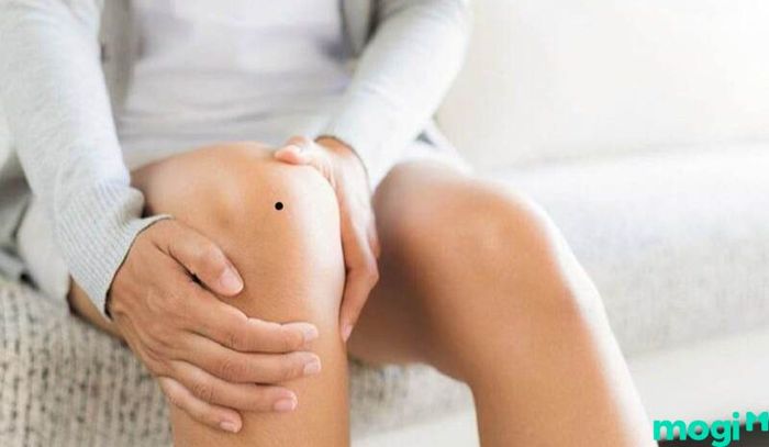 Cuộc sống tình cảm của phụ nữ có nốt ruồi ở đầu gối thường gặp trắc trở
