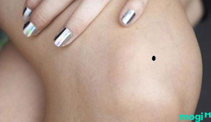 Nốt ruồi ở đầu gối mang nhiều ý nghĩa khác nhau