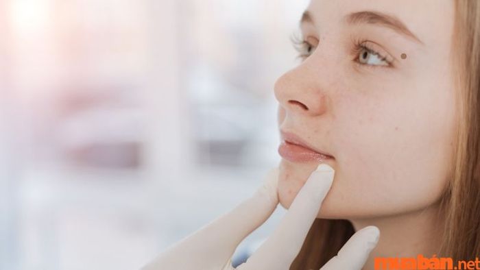 Có nên xóa nốt ruồi ở mắt hay không?