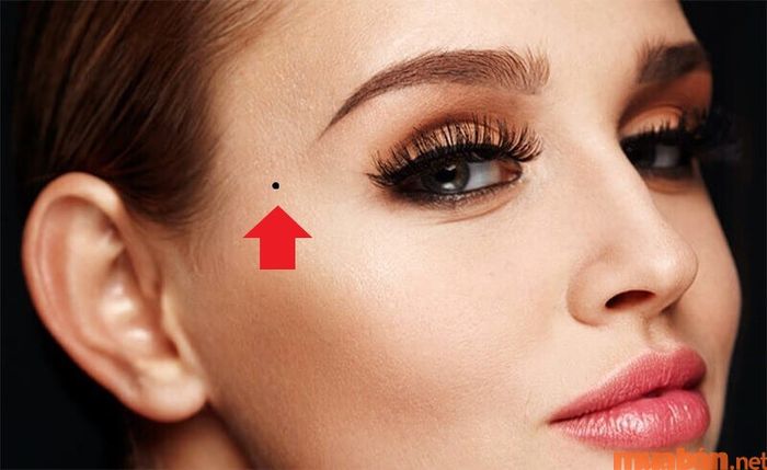 Ý nghĩa của nốt ruồi khi xuất hiện ở thái dương là gì?
