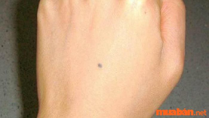 Nốt ruồi xanh ở hai tay là dấu hiệu cho thấy chủ nhân sẽ trải qua nhiều khó khăn trong tình duyên