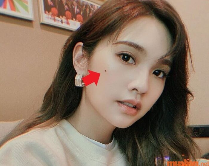 Nốt ruồi tài lộc ở gò má có ý nghĩa gì?