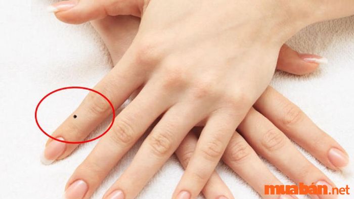 Nốt Ruồi Trên Tay Trỏ Mang Lại Nhiều May Mắn