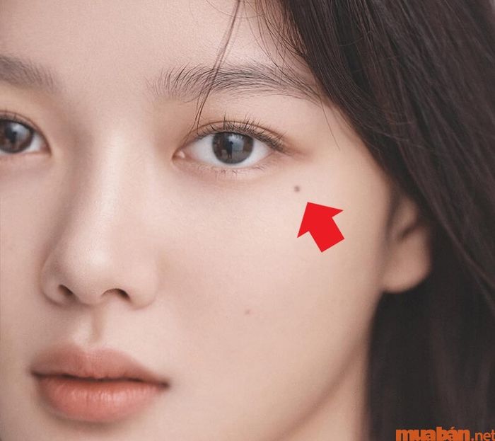 Nên lo lắng khi có nốt ruồi ở khóe mắt không?