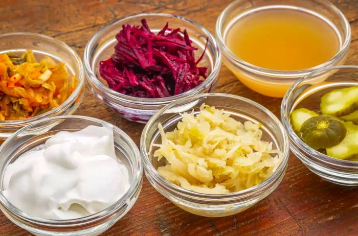 A selection of gut-friendly fermented foods: kimchi, red beets, apple cider vinegar, coconut yogurt, cucumber pickles, and sauerkraut.