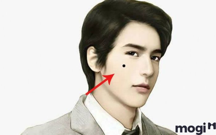 Nốt ruồi trên mặt đàn ông ở vùng gò má