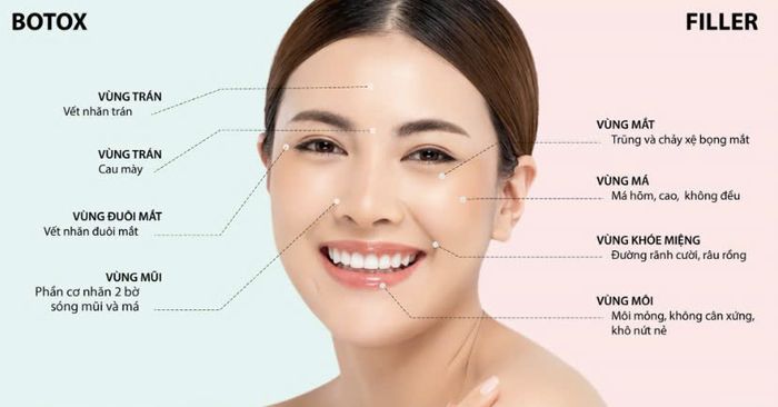 filler botox hcm.jpg