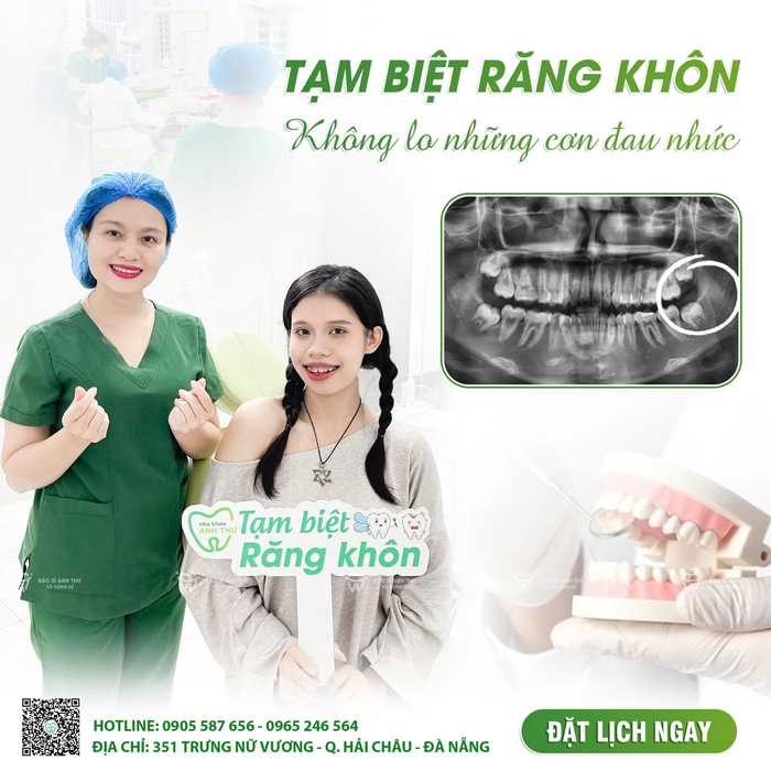 nha khoa rang khon da nang 2.png