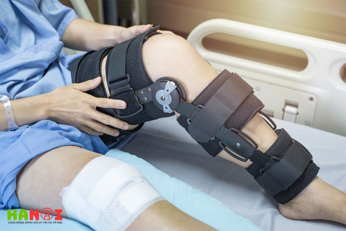 Người bệnh cần dành thời gian nghỉ ngơi và sử dụng nẹp trong giai đoạn đầu sau phẫu thuật.