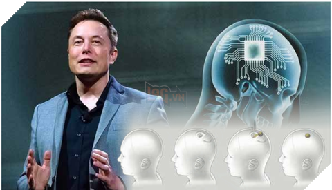 Elon Musk dự báo tiến trình phát triển công nghệ cấy chip não người trong vòng 20 năm tới
