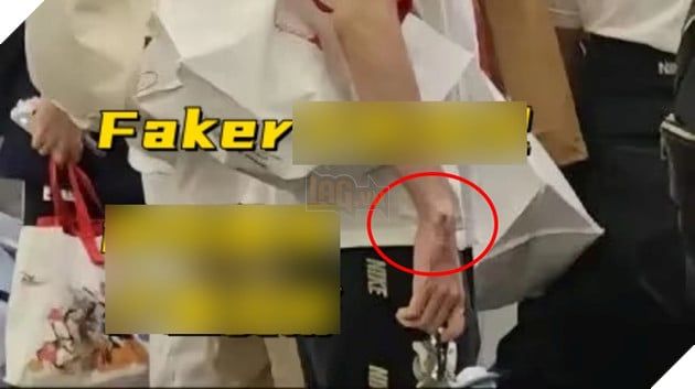 LMHT: Nguyên nhân chấn thương của Faker đã được tiết lộ liên quan đến lịch trình luyện tập căng thẳng không ngừng.