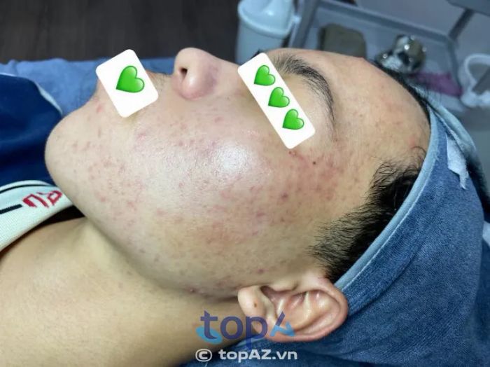 ANH MAI Skinlab Dĩ An