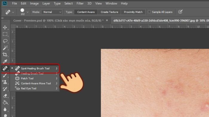 Hướng dẫn xóa mụn bằng Healing Brush Tool bước 1 (Kèm hình ảnh minh họa)