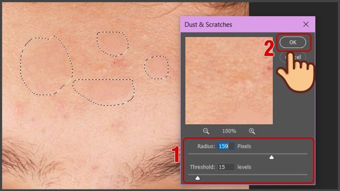 Hướng dẫn loại bỏ mụn trong Photoshop sử dụng Lasso Tool bước 4 (Kèm hình minh họa)