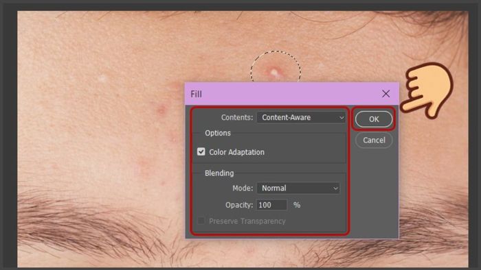 Hướng dẫn loại bỏ mụn trong Photoshop sử dụng lệnh Fill ở bước 4 (Kèm hình ảnh minh họa)