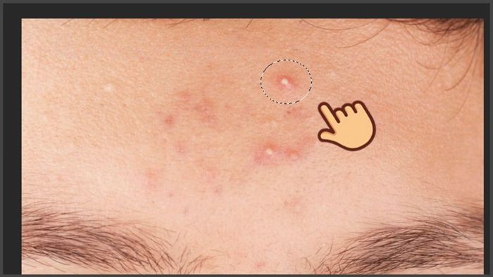 Hướng dẫn loại bỏ mụn trong Photoshop sử dụng lệnh Fill bước 2 (Kèm hình minh họa)