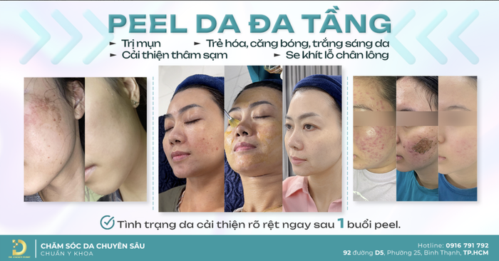 peel da thay da sinh hoc hcm 2.png