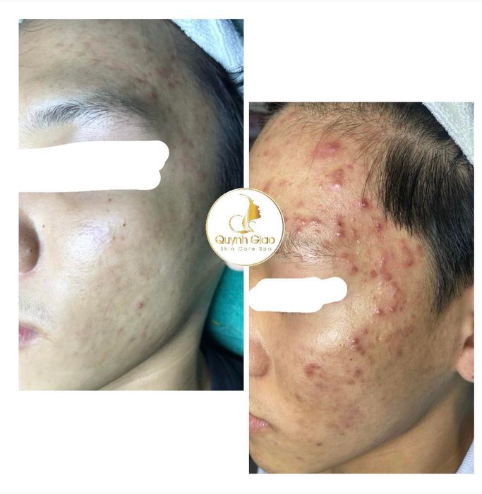 Quỳnh Giao Spa Photo 2
