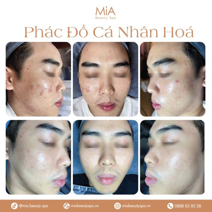 MiA Beauty Spa image 1
