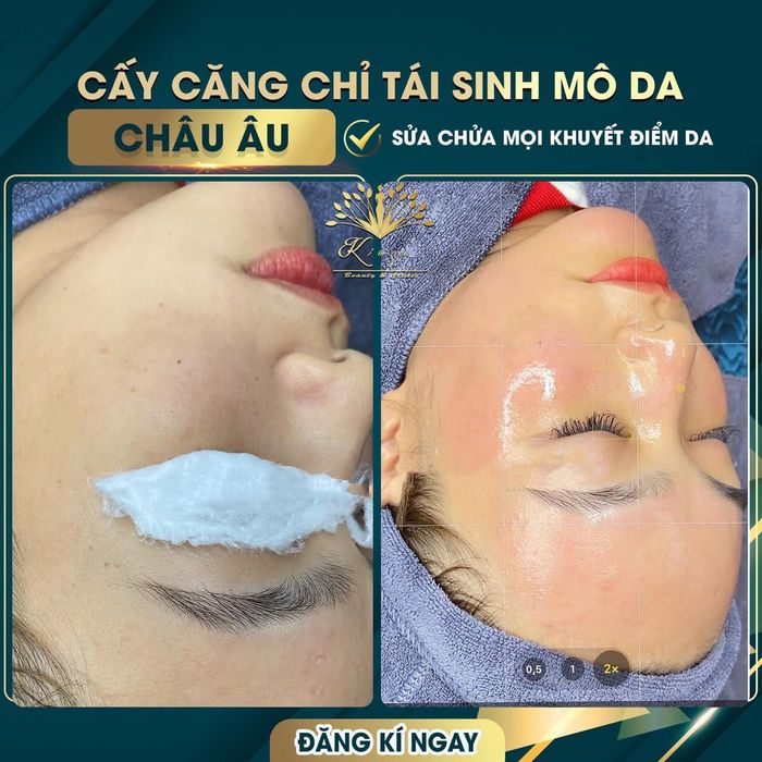 The second image of Kim Spa in Tay Ninh showcases its serene ambiance and modern facilities. The space is designed to provide a comfortable and luxurious environment, perfect for those looking for a rejuvenating experience. The spa's staff is attentive, ensuring that each guest enjoys the highest level of service.