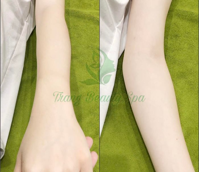 Trang Beauty Spa Image 1